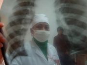 Descoberta nova lesão pulmonar ligada a cigarros eletrónicos com líquido